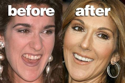 celine dion fake teeth|celine dion new look.